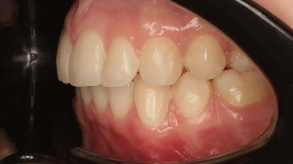 Портфолио - до 3