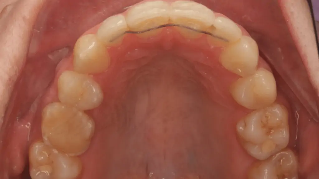 Портфолио - до 5