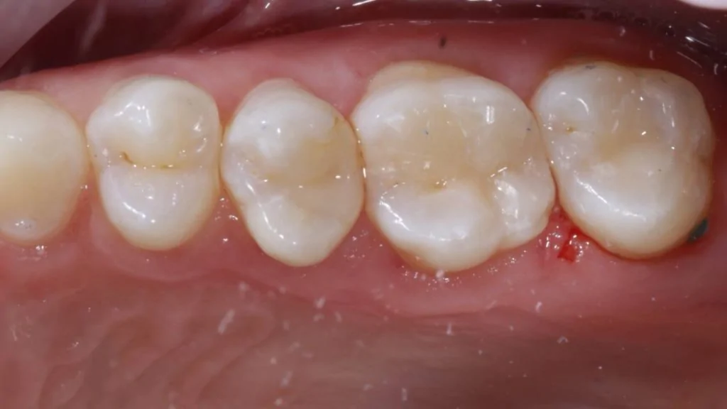 Портфолио - основное изображение