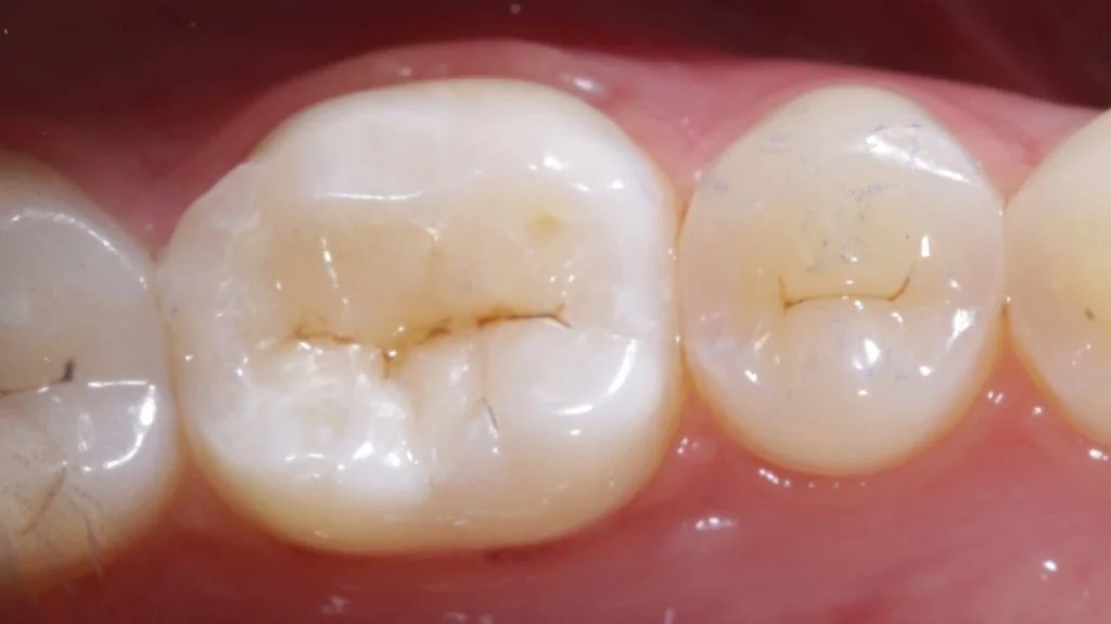 Портфолио - основное изображение