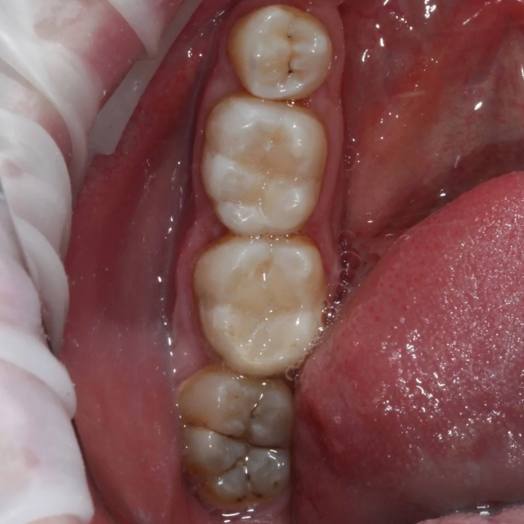 Портфолио - основное изображение