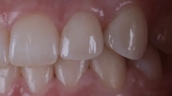 Портфолио - до 4