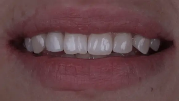 Портфолио - до 2