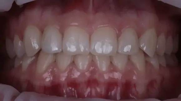 Портфолио - основное изображение